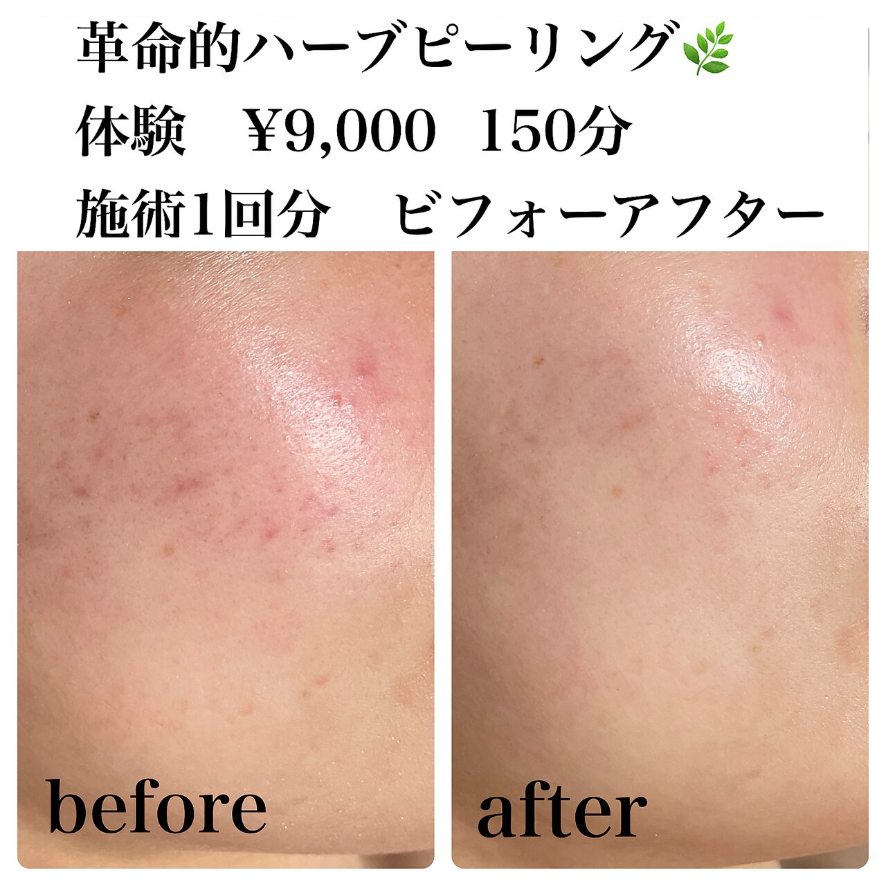 ご相談（無料）